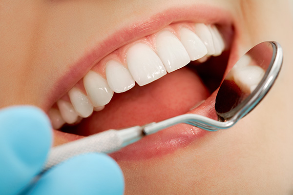Fillings